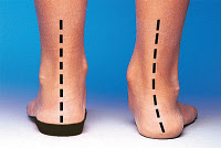 Pronation fatigue best sale